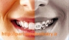 دندانپزشکی | ایمپلنت | لامینت | طرح لبخند parhamdentistry