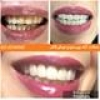 دندانپزشکی | ایمپلنت | لمینت | طرح لبخند yousefdentistry